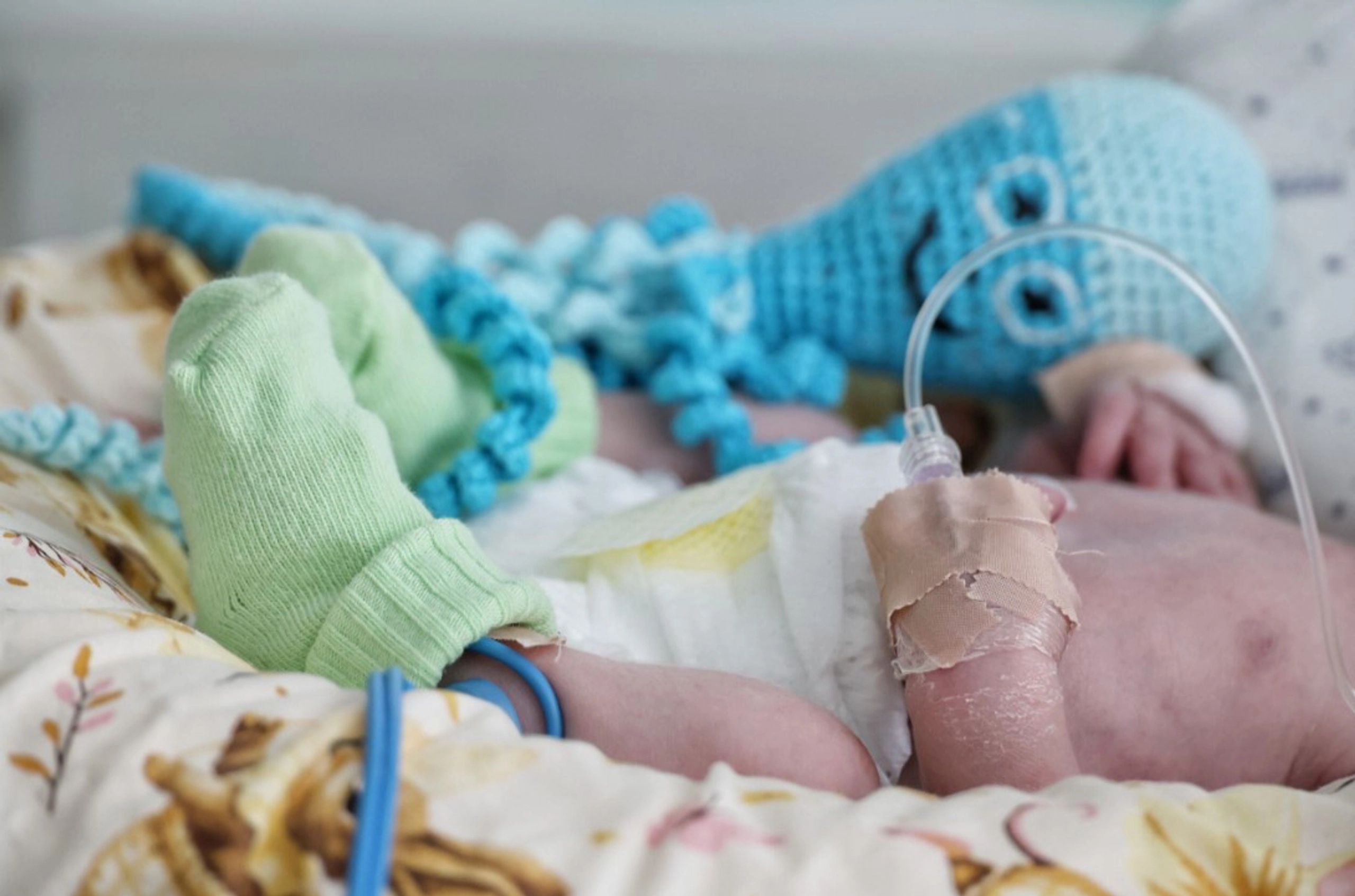 Одеське сонце допомагає рятувати новонароджених дітей