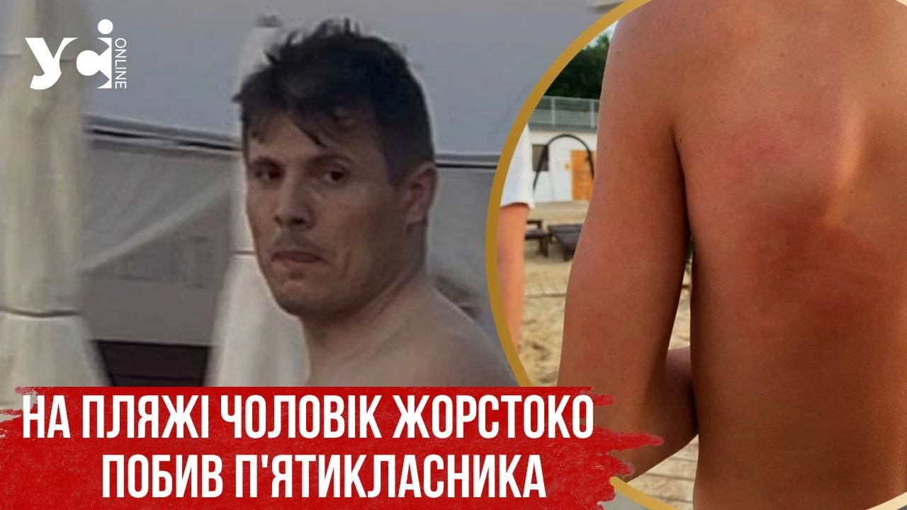Скандал на пляжі в Одесі: чоловік побив хлопчика, який сперечався з його донькою, до струсу мозку