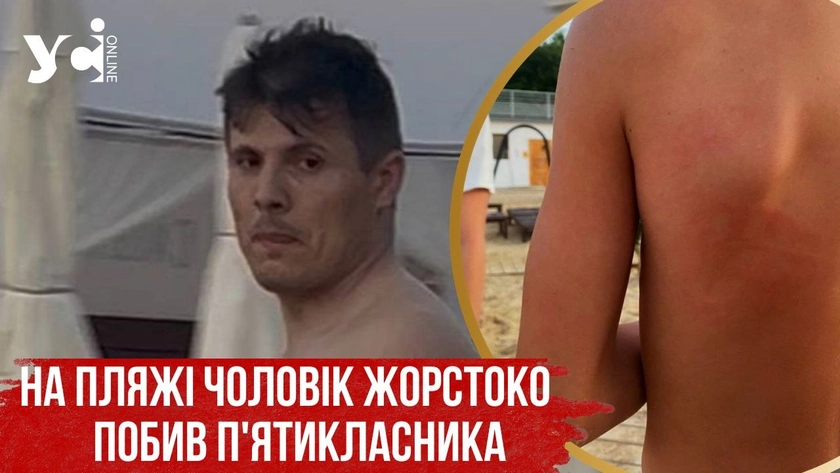 Скандал на пляжі в Одесі: чоловік побив хлопчика, який сперечався з його донькою, до струсу мозку